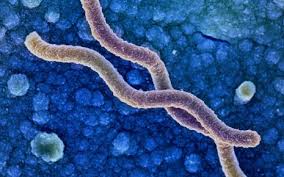 Helicobacter Pylori Ursachen Symptome Behandlung Onmeda De