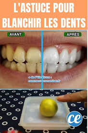 Une Astuce Etonnante Pour Avoir Les Dents Blanches Naturellement En 2020 Blanchir Les Dents Avoir Les Dents Blanches Astuce Dent Blanche