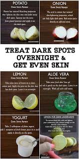 Dark Spots Are Also Known As Freckles Sunspots Age Spots Etc And Are Caused By Excess Exposure Of The Skin To The Sun Skin Spots Natural Skin Care Skin Care