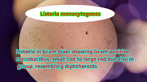 Viewing bacteria under microscope allows for observations of their morphology, physiology and behavior. Listeria Monocytogenes Under Microscope Youtube