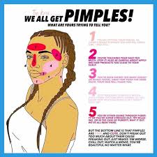 How You Can Put A Stop To Pimples In 5 Simple Steps Pimples Put Simple Steps Stop Pimples Skin Care Acne Beauty Skin Care