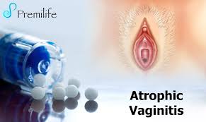 Image result for Vaginitis