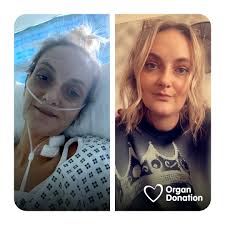 Liver Transplant Recovery and Emotional Struggles