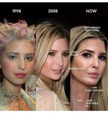 She doesn't seem to age and there appear to be some unnatural features on her face and body. Ivanka Trump Botchedsurgeries