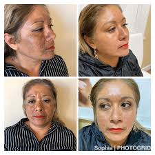 Bobby's skin care clinic