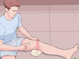 Eine Bakerzyste Behandeln Wikihow