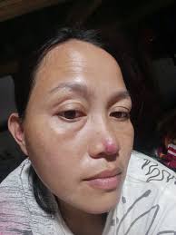 Baka po may Alam kayo Kung Anu pwedi gamot Sa bunso ko Tenga nya KC may  sipon pabalik balik din ang sipon nya ganito po ba talaga pag Mahina ang  baga? Salamat