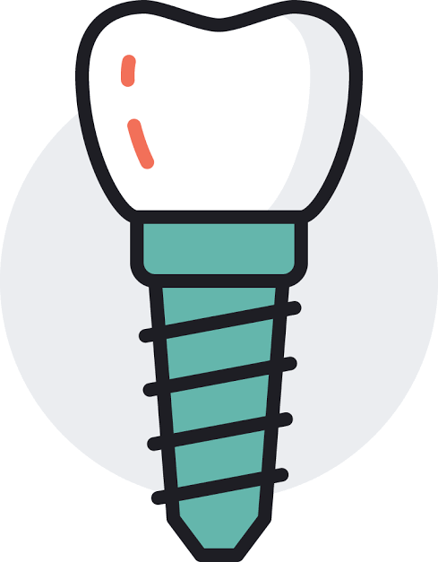 Icon Implant Gigi
