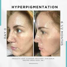 NeoGenesis: A case study of its skincare products