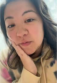 Follistim Aq Not Refrigetated