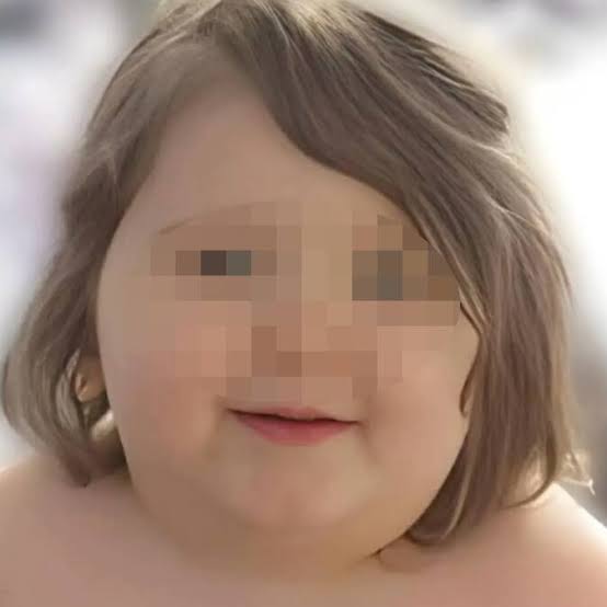 USA: Junge (†7) stirbt an Übergewicht und Vernachlässigung - Blick