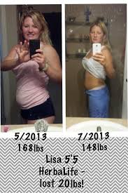 Pin On Before After Pictures