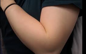 Es ist aber auch nervig, wenn man sich dazu entscheidet, seine haare an beinen, armen oder im intimbereich regelmäßig zu entfernen. Wie Oft Sollte Ich Mir Die Arme Rasieren Haut Haare Korper Beauty