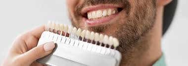 Are veneers covered by health insurance. How Much Do Veneers Cost The White Bite