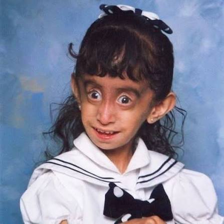 Once called "The Ugliest Woman in the World," Lizzie Velasquez, who was  born with a rare syndrome that prevents her from gaining weight, is now  doing incredibly well. Check the comments! 👇