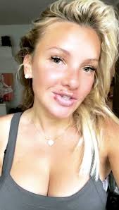 Weitere ideen zu evelyn burdecki, promis, let's dance. Pechvogel Evelyn Burdecki Hat Vier Lippen Herpesblaschen Promiflash De