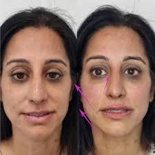 Laura Haig Aesthetics