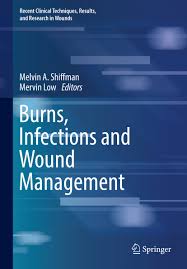 Image result for Burn Management