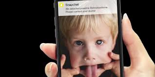 RETINOBLASTOMA: É POSSÍVEL PREVENIR E CURAR!