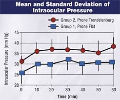 spine surgery position may increase risk for postop vision loss