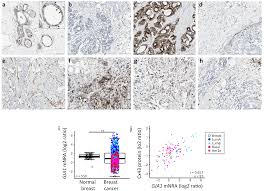 The scalable brain atlas does not own any of its templates. Ijms Free Full Text The Complex Subtype Dependent Role Of Connexin 43 Gja1 In Breast Cancer Html