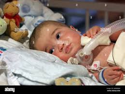 Brain surgeries hi-res stock photography and images