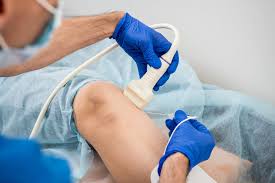 Image result for Radiofrequency Surgery