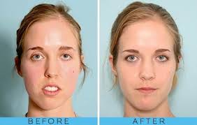 What makes a Stacy vs a Becky : r/Vindicta