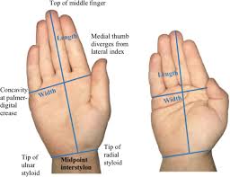 Review Of Methods To Determine Hand Surface Area Of Children Less Than Six Years Old A Case Study Springerlink