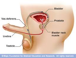 As the cancer grows, you may have trouble urinating. Prostate Cancer Symptoms Benefits Of Early Diagnosis