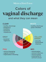Image result for Vaginal Discharge Testing
