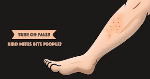 Image result for mite bites on humans