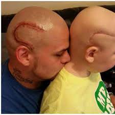 Josh Marshall, el padre que se tatuó la cicatriz de su hijo en la cabeza,  despide a su pequeño Gabriel Marshall