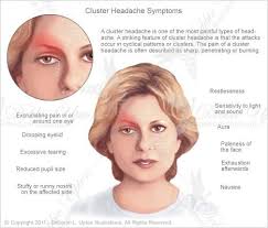 Pin By Queen Ladykelz On Allergies Treatments Cluster Headaches Headache Symptoms Cluster Headaches Relief