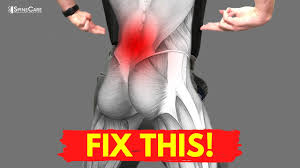 If you are suffering from a stiff, aching hip, there's a chance that you have developed bursitis. How To Fix Your Lower Back Pain For Good Youtube