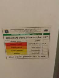 Apa kata, ambil sedikit masa yang sekejap saja untuk melihat warna air kencing anda tersebut. Jangan Lupa Perhatikan Warna Urin Ketika Buang Air Kecil Halaman All Kompasiana Com