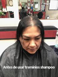 Gracias Leticia Paredes por compartir las fotografías del testimonio de la  diferencia que tiene por usar #treminios Argan and Eucalyptus shampoo. Nos  satisface el como el producto está ayudándole ...