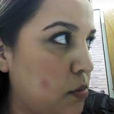 1700 e barnett rd, medford, or 97501. Valley Aesthetics And Laser Closed 75 Photos 68 Reviews Medical Spas 2219 S Hacienda Blvd Hacienda Heights Ca Phone Number Yelp