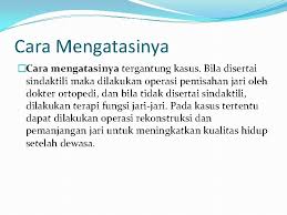 National legal aid & defender association recognizes o'melveny with beacon of justice award. Polidaktili Dan Brakidaktili Aldo O M M Arkan
