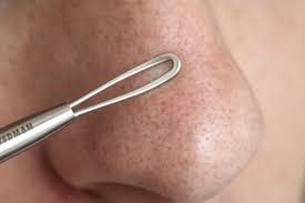 Those with increased production of sebum have naturally oilier skin and are typically more likely to experience blackheads. Pin On Hair Beauty That I Love
