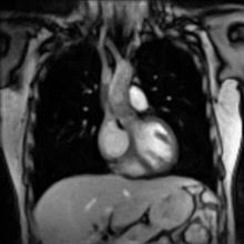 How long is a mri scan good for? Magnetic Resonance Imaging Wikipedia
