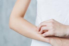 Watch about jock itch pictures in females and males (women and men). Are Stds And Skin Rashes Related Abelcare