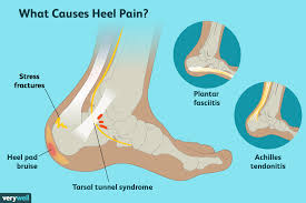 The peroneal tendon runs from the lower foot, moves under the lateral malleolus (prominence on the outside of foot) and attaches to the midfoot and inner side of the arch. Heel Pain Causes Treatment And When To See A Doctor