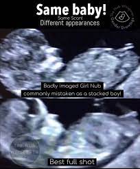 Nub Theory Nub Theory Gender Prediction Gender
