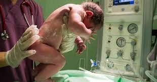 Falah lahir 37 minggu 2.5 kg. Bolehkah Melahirkan Di Usia Kandungan 37 Minggu Popmama Com