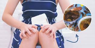 Christina wichman, associate professor of psychiatry and obstetrics and gynecology at the medical college of wisconsin, says that pregnant women with milder adhd symptoms can go off. Senna Tea Healthy Natural Laxative Or Gut Irritant Dr Axe