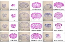 2 Representative Mouse Brain Reference Chart For Each Cryo