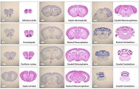 2 representative mouse brain reference chart for each cryo