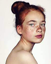 Photographer Takes Portraits Of Freckled People To Celebrate Their Unique Beauty People With Freckles Beautiful Freckles Unique Faces