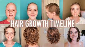 Your hair may initially be curly, coarse, or even fine like baby hair. First Haircut After Chemo 2 Years Later Youtube